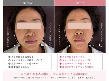 ビーエムジム ボディーメイクラボ(BMGYM.BODYMAKELAB)の写真/強くこすらない小顔整体で顔からキレイに◎優しく整える施術で心も身体もリフレッシュ☆
