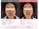 ビーエムジム ボディーメイクラボ(BMGYM.BODYMAKELAB)の写真/強くこすらない小顔整体で顔からキレイに◎優しく整える施術で心も身体もリフレッシュ☆