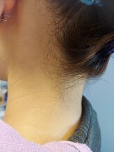 キアラ 麻布十番(Kiara)/えりあし脱毛うなじ脱毛