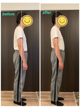 深層整筋サロン/施術before&After(40代男性)