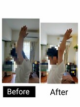 アース エンジェル整体院/ビフォアフ　肩こり　ストレッチ