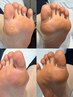【*ご新規様*】Footワンカラー+かかとつるふわ☆ベイビースキン角質ケア 