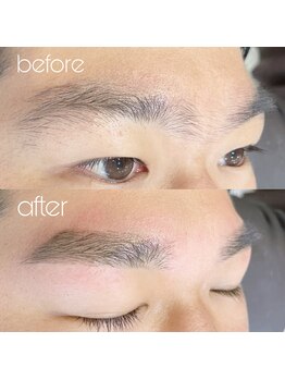 ネオン(Neon.)/before→after