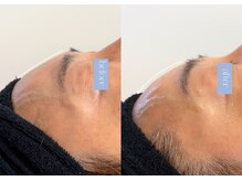 ステラ(STELLA)/東洋医学に基づいて・・・