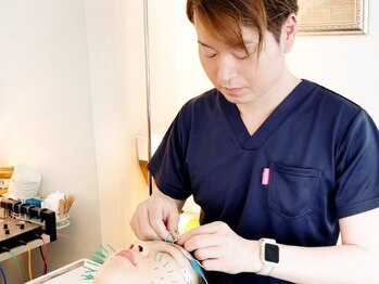 アオヤマ サロン ワイゼット(AOYAMA SALON YZ)の写真/《20代30代女子御用達》美活(エイジングケア)は早い方が絶対にいい!美容鍼デビューは当サロンへ