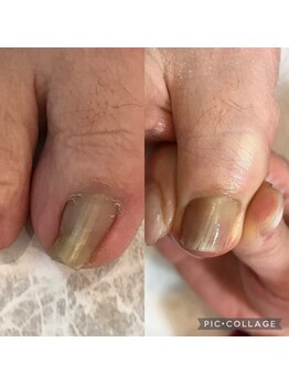 ネイルプルーフ(NAIL proof)/