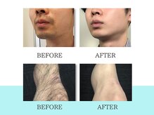 スキンラボ ドットシキブ 厚木海老名店(skinlabo .sikibu)/