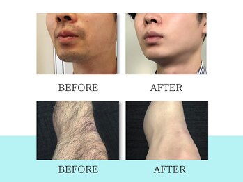 スキンラボ ドットシキブ 厚木海老名店(skinlabo .sikibu)/