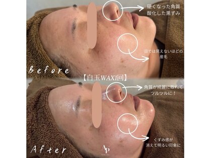 アピュルテ(A purete')の写真