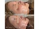 アピュルテ(A purete')の写真