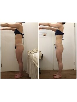 ボーレーヴ(beau reve)の写真/【本気痩せならエンダ×インディバ×ハンドの徹底コース】深部の燃焼により代謝UP×血行促進でデトックス♪