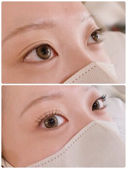 パールブルー(All Perl blue)/【before &nbsp;after】