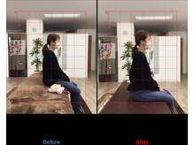 ストレチックス 近江八幡店/BeforeAfter