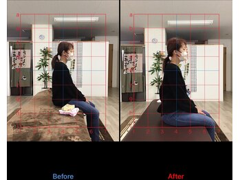 ストレチックス 近江八幡店/BeforeAfter