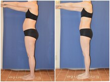 アンシャンテ姫路/40代 痩身ダイエット 姫路エステ