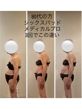 アンリール(ANRIRE)/シックスパッド！