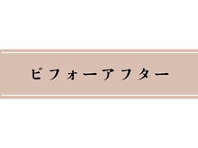 富雄みなみ整骨院/施術後のビフォーアフター