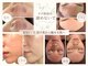 ハミングスキン(Humming skin)の写真