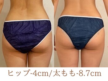 美ジン なかもず(美JIN)/セルゼロ12回
