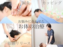 ナツメ鍼灸院(natume鍼灸院)の雰囲気（鍼灸/整体/カッピング/筋膜リリース、お悩みに合わせた施術）