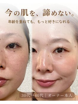 ウィル 二子新地(will)の写真/情報に振り回される美容は、もう終わり。年齢を重ねても、自分の肌を好きでいたい大人女性へ。