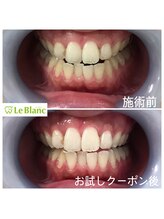 ルブラン 奈良店(Le Blanc)/効果実感できる
