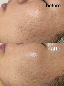 ユイット ルッカ(Huit Lucca)/アクアダーマ