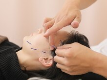 つじい鍼灸整骨院