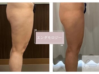 アールグランド 経堂店(R-ground)/セルケア×エンダモロジー