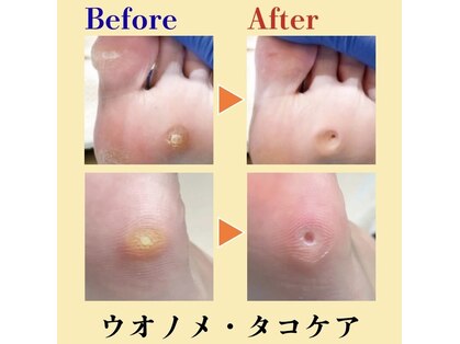 巻き爪補正店 北千住店の写真