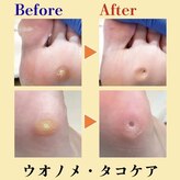 巻き爪補正店 北千住店