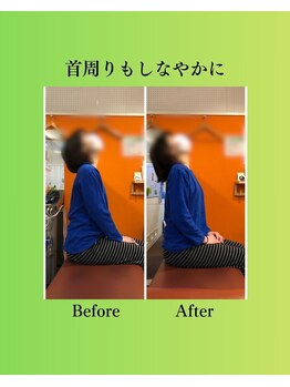 コア カイロプラクティック 錦糸町/ビフォーアフター 錦糸町/亀戸