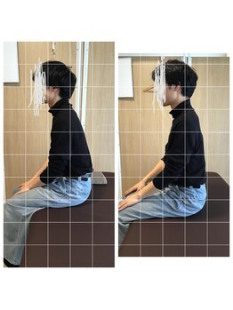 ゼンス整体 青葉台院(ZENCE整体)/施術のBefore after