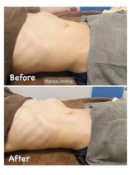 グレースヒーリング(GRACE HEALING)/本日の腸もみ