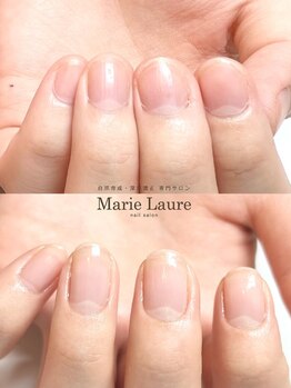 マリーロール 梅田店(Marie Laure)/自爪育成/深爪矯正/ネイルケア