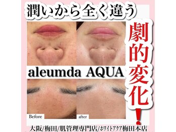 ホワイトアクア 梅田本店(WHITE AQUA)/ハーブピーリング/大阪/梅田