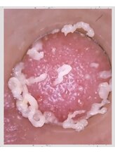 メルディアナ(MAR DIANA)/クリスタル毛穴洗浄