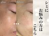 2月末迄　残り4名様　初回のみ【シミケア放題20分】※40個迄　¥12000→¥6600