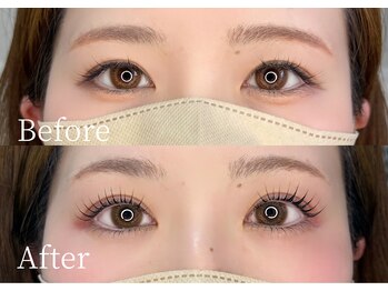 シャルリス(CHALELISS)/右目だけ下がる。原因あります!