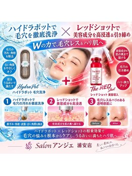 脱毛サロン アンジェ 浦安店の写真/【浦安初!!韓国美容レッドショット】毛穴洗浄付★脂肪分解＋引き締め＋美肌・エイジングケアが同時に叶う♪