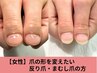 【お試し】女性●爪の形にコンプレックスをお持ちの方/まむし爪さん￥16500→