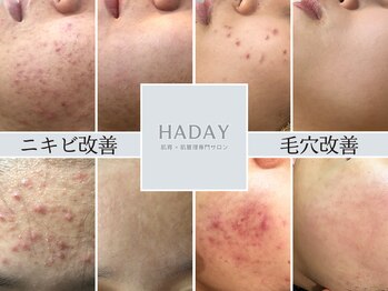ハダイ(HADAY)