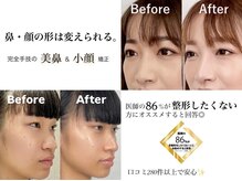 ラプリ 札幌ル・トロワ店の雰囲気（完全手技の美鼻＆小顔矯正♪#小顔#小顔矯正#小顔整体#隆鼻矯正）