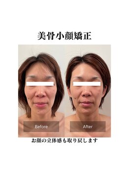 エムドット プラス(M DOT +)/美骨小顔矯正