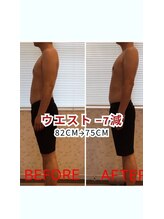 にしやま整骨院/ダイエット/美容整体/頭痛改善