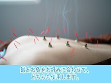 鍼とお灸をお好みに合わせて、どちらも使用します。
