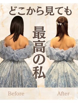 リアン整体院/【華奢見え】ドレス映え！