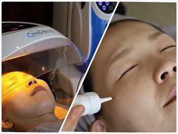 ルアンジュ(Le Ange)の写真/シミ改善ホワイトモードで、気になるシミにアプローチ！透明感あふれる素肌を目指します☆（40文字）