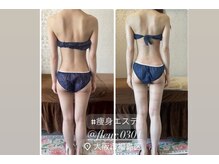 フルール 福島店(FLEUR)の雰囲気(Instagramでサロンの雰囲気もご覧ください【@fleur.0301】痩身)