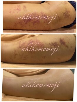 エムグレイス(m-grace's)/美容整形術後ケア